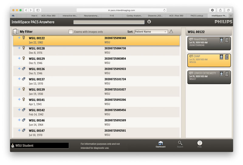 pacs-navigation-hotspot